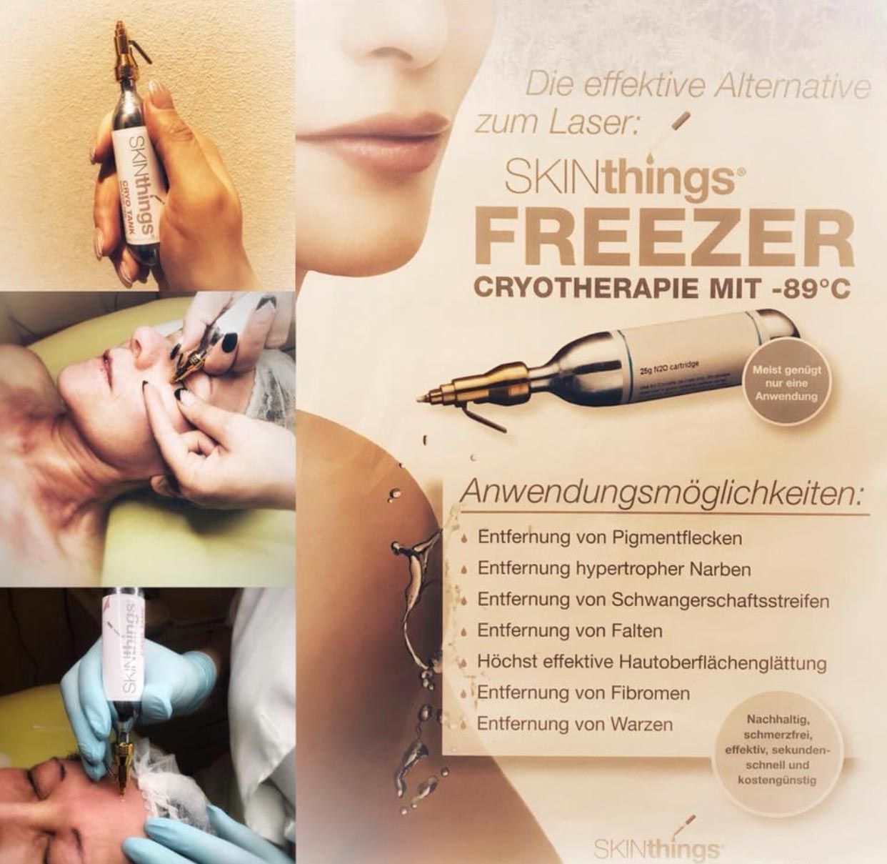 Cryo Skin Anwendungsmöglichkeiten